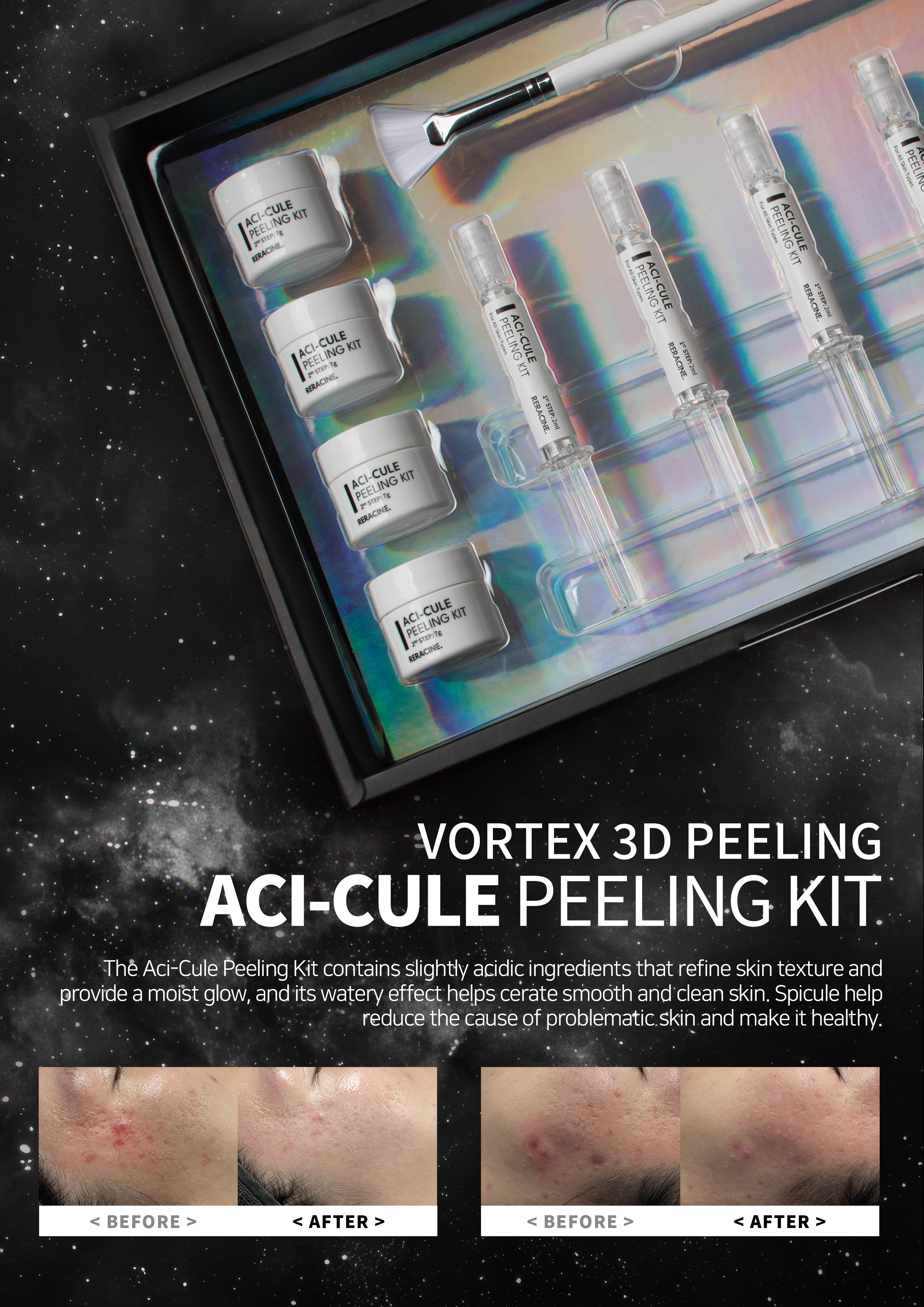 [Reracine] ACI-CULE Peeling Kit