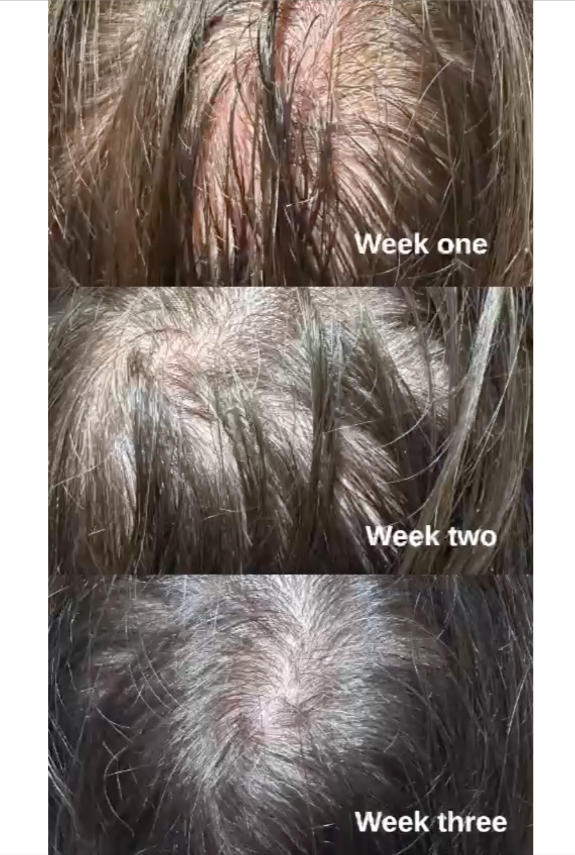 [BAO H. LAB] Hair Loss Care Ampoule