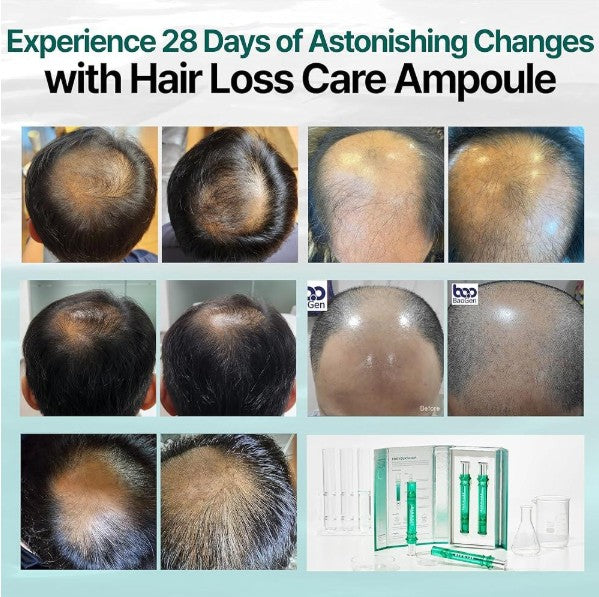 [BAO H. LAB] Hair Loss Care Ampoule